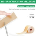 thumbnail image 2 of Aliver 60 inch Silicone Scar Roll, Adhesive Silicone Tape for Scar Tape, 2 of 8