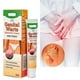thumbnail image 2 of Maximum Strength Fast Acting Gel Wart Remover Ointment Genital Herpes Creams, 2 of 5