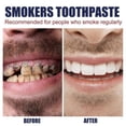 thumbnail image 5 of Remove Smoke Stains Toothpaste Smoke Stains Remove Teeth Stains Remove Yellow Clean Teeth Bright White Fresh Oral Care Toothpaste, 5 of 5