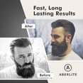 thumbnail image 2 of Aberlite EDC - Men's Professional Heated Beard Straightening Brush and Grooming Tool (for 0.5 inch plus Beards) (Black), 2 of 5