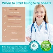 Medical-Grade Silicone Silicone Scar Sheets,Reusable & Breathable Silicone Scar Tape 1.6x 60,Visible Scar Reduction after 2-6 Months