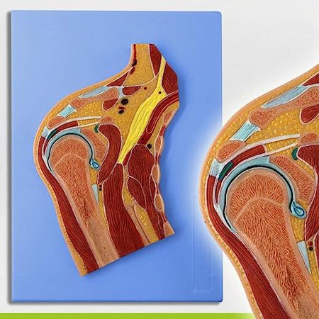 Wellden Medical Anatomical Shoulder Joint Section Model