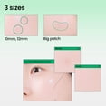thumbnail image 4 of Parches hidrocoloides para granitos Acne Spot Patch ilso, 72 unidades, con niacinamida, 4 of 9