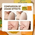 thumbnail image 5 of AMVital Kojic Acid Soap for Dark Spots, Turmeric Soap for Face & Body with Hyaluronic Acid, Vitamin C, Vitamin E, Shea Butter, Castile Olive Oil (2 Pack), 5 of 10