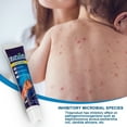 thumbnail image 4 of Crema Antiprurítica Para Urticaria, Pomada Antipicazón, Crema Antipicazón, Crema Antipruriginosa Para Urticaria, 20g, Pomada Antipicazón A Base De Hierbas Naturales ANGGREK Anti Itch Cream, 4 of 8