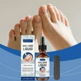 thumbnail image 4 of Solución para el cuidado de las uñas Essence Nutre y suaviza suavemente las uñas para un acabado brillante y cómodo Cuidado diario para manos y pies Solución para el cuidado de las uñas 30 ml, 4 of 9