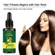 thumbnail image 4 of Aceite esencial HUOGUO Jengibre para el cuidado del cabello, crecimiento del cabello, 30 ml, 4 of 5