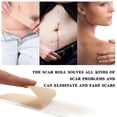 thumbnail image 4 of Professional Silicone Scar Sheets for C-Section/Surgery/Burn/Keloid Scars, 4 of 5
