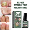 thumbnail image 5 of Extra Strength Nail Repair Fluid - Natural Toenail & Nail Fungus Cure, Discoloration Damage Repair, Anti-Paronychia Solution, 5 of 5
