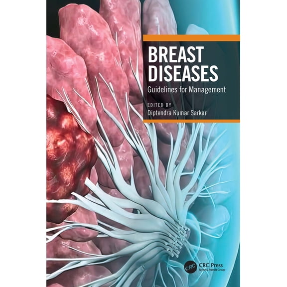 Breast Diseases: Guidelines for Management, (Paperback)