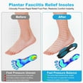 thumbnail image 4 of Plantar Fasciitis Insoles Arch Support Inserts Orthotics Shoe Inserts for Men Women,Rapidly Relief Plantar Fasciitis Foot Pain, Flat Feet, High Arch,Over Pronation,X/O Legs Correction, 4 of 4