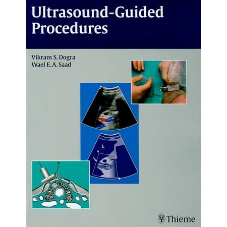UPC: 9781604061703 | Ultrasound-Guided Procedures (Paperback)