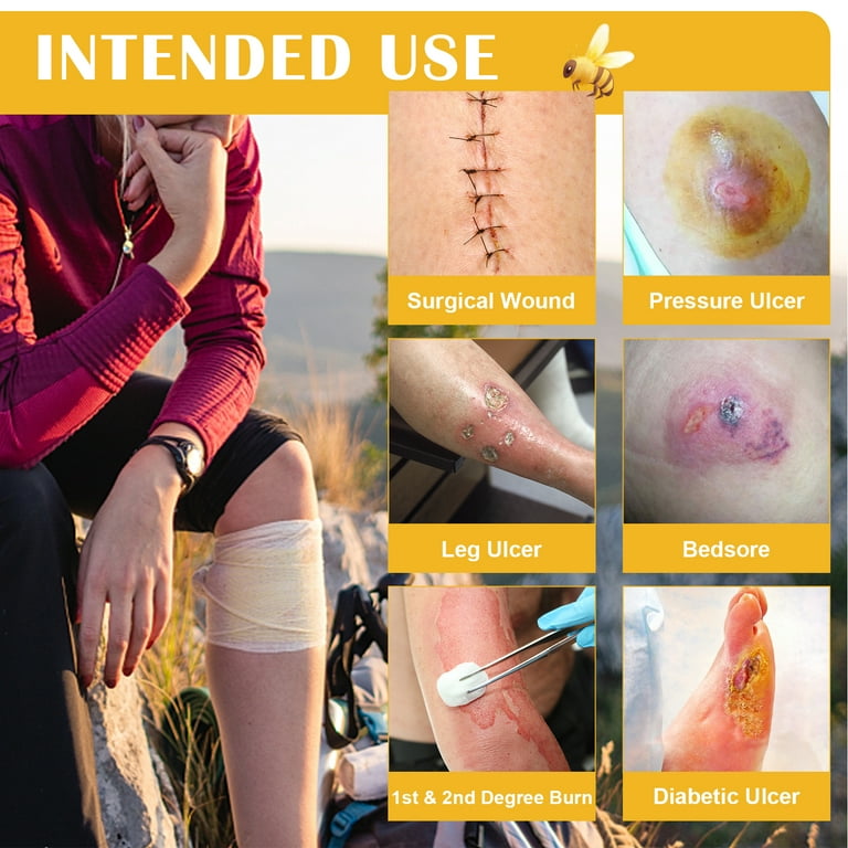 置物 the wound does not heal What to Do When a Wound Just Won't Heal | University of Utah Health