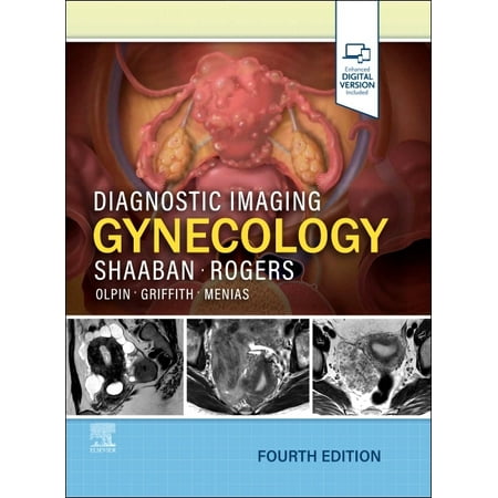 Diagnostic Imaging Diagnostic Imaging: Gynecology (Hardcover)