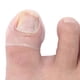 thumbnail image 4 of Herramienta de Tratamiento de Paroniquia Jinwen Corrector de Uñas Encarnadas, 4 of 8