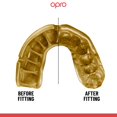 thumbnail image 6 of OPRO Gold Level Mouth Guard – Moldable Mouthguard for Boxing, MMA & Football (Black, Adult), 6 of 7