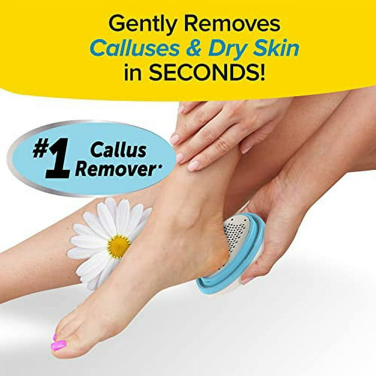  PedEgg Classic Callus Remover, As Seen On TV, New Look, Safely  and Painlessly Remove Tough Calluses & Dry Skin to Reveal Smooth Soft Feet,  135 Precision Micro-Blades, Traps Shavings Mess-Free 