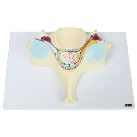 Axis Scientific Spine Model of Enlarged 5th Cervical Vertebra | Anatomy Model has 27 Labeled Anatomical Parts and Details Internal Spine Anatomy | Includes Product Manual | 3 Year Warranty price history on PriceWatchPro