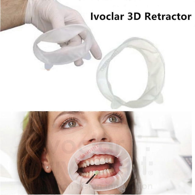 OptraGate 3D Dental Mouth Opener Lip Cheek Retractor O Shape Regular Small Ivoclar Vivadent Teeth Whitening--5Pcs Mixed