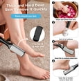 thumbnail image 4 of Livhil 36 in 1 Professional Pedicure Kit, Stainless Steel Pedicure Tools for Feet, Foot Care Kit for Women and Men, 4 of 9