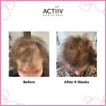 thumbnail image 4 of Recover Thickening Shampoo Treatment for Women Recover by ACTiiV Hair Science, 4 of 5