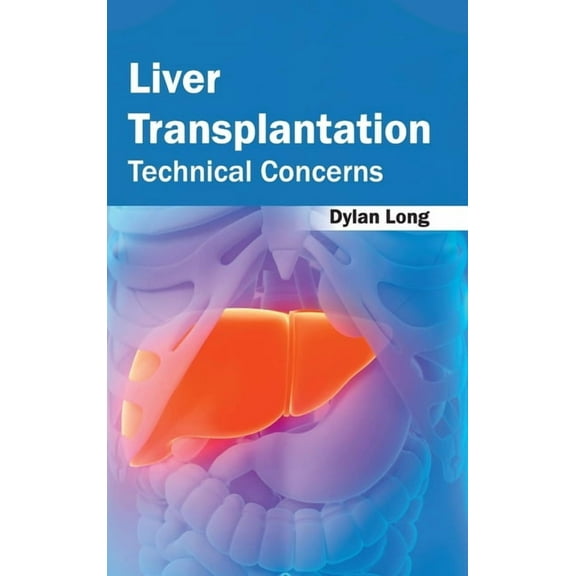 Liver Transplantation: Technical Concerns, (Hardcover)