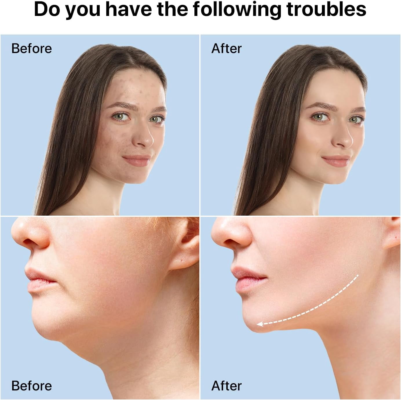 Red Light  for Face and Neck, 8-in-1 Led Face Neck Massager for Skin Care