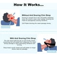 thumbnail image 4 of Anti-Snoring Chin Strap Devices, Chin Strap for Sleeping, Effective Stop Snoring Solution, Adjustable Breathable Chin Strap for Men and Women Sleeping, Black06, 4 of 7