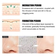 thumbnail image 3 of Mascarilla Para Quitar Puntos Negros Máscaras de eliminación de espinillas de suciedad de 15 g para hombres mujeres máscaras de peeling de té verde cuidado de la piel Sywqhk Cuidado Belleza, 3 of 9