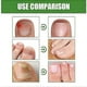 thumbnail image 2 of 3x Nail Shield Anti-fungal Stick Nailshield Anti Fungal Stick,monsalife Nail Shield Anti Fungal Stick, 2 of 5