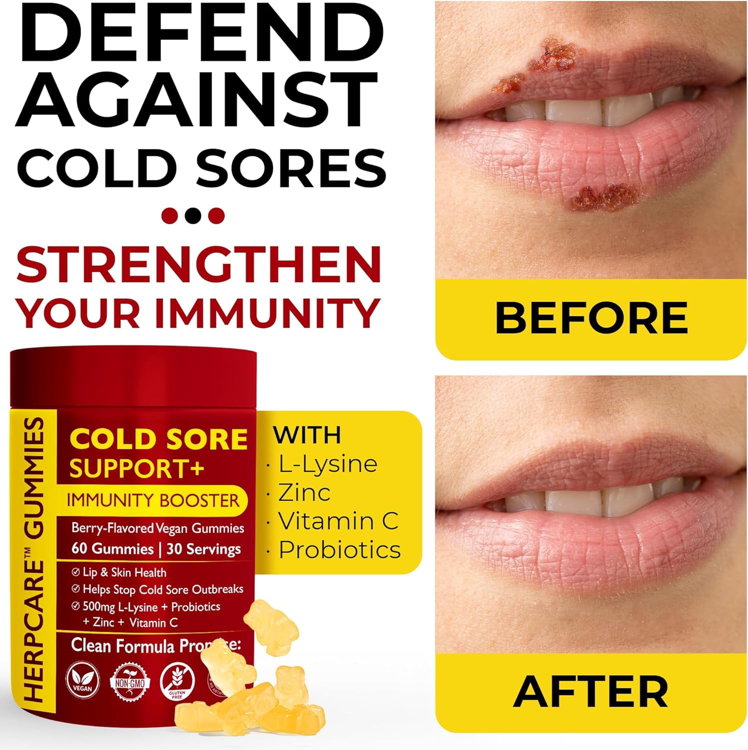 Cold Sore Treatment for Lip & Skin Support with L-Lysine, Zinc, Vitamin C & Probiotics