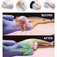 thumbnail image 2 of SQDWYGG Revoget Alignment Pillows for Side Sleepers, Relieve Hip Pain & Sciatica, Revoget Hip Alignment Pillow with Adjustable Strap,Navy Blue,9.8" x 9"x 5", 2 of 8