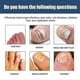 thumbnail image 5 of 1-3x Antifungals Nail Treatments Spray In Medicals Quality, 30 Ml, Antifungals Nail Treatments, Antifungals Spray 30ml, 5 of 5