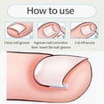 thumbnail image 4 of 10/12pcs Corrector Uñas Encarnadas Pro Cuidado La Los Pies en Forma C (01), 4 of 9