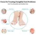 thumbnail image 3 of Toe Separator for Feet Correct Toes Yoga 10 Pieces Silicone Hammer Toe Corrector for Women & Men Correct Toe Straighteners for Overlapping Toes, 3 of 7