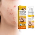 thumbnail image 3 of Pimples Nourishing, Pimples Cream Gently ,Brightens Facial Skin Pimples Treatment,Salicylic Skin Nourishing Removal,Shrink Pores Face Care Pimples Salvador Dali Espinillas Nutritivo, 3 of 5