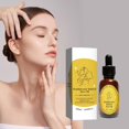 thumbnail image 2 of Improve Dark Yellow Moisturizing And Skin Frankincense Oil 30ml, 2 of 9