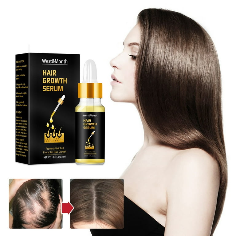 Hair growth kids deals