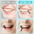 thumbnail image 6 of 120pcs Spiral Interdental Brushes Teeth Cleaning Tool for Braces Oral Care, 6 of 7