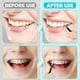 thumbnail image 4 of 120 Cepillos Interdentales, Limpiador de Cepillos para Aparatos Ortopédicos para Herramientas de Limpieza de Dientes, Cepillo Dental en Espiral para un Cuidado Bucal Eficiente A, 4 of 5