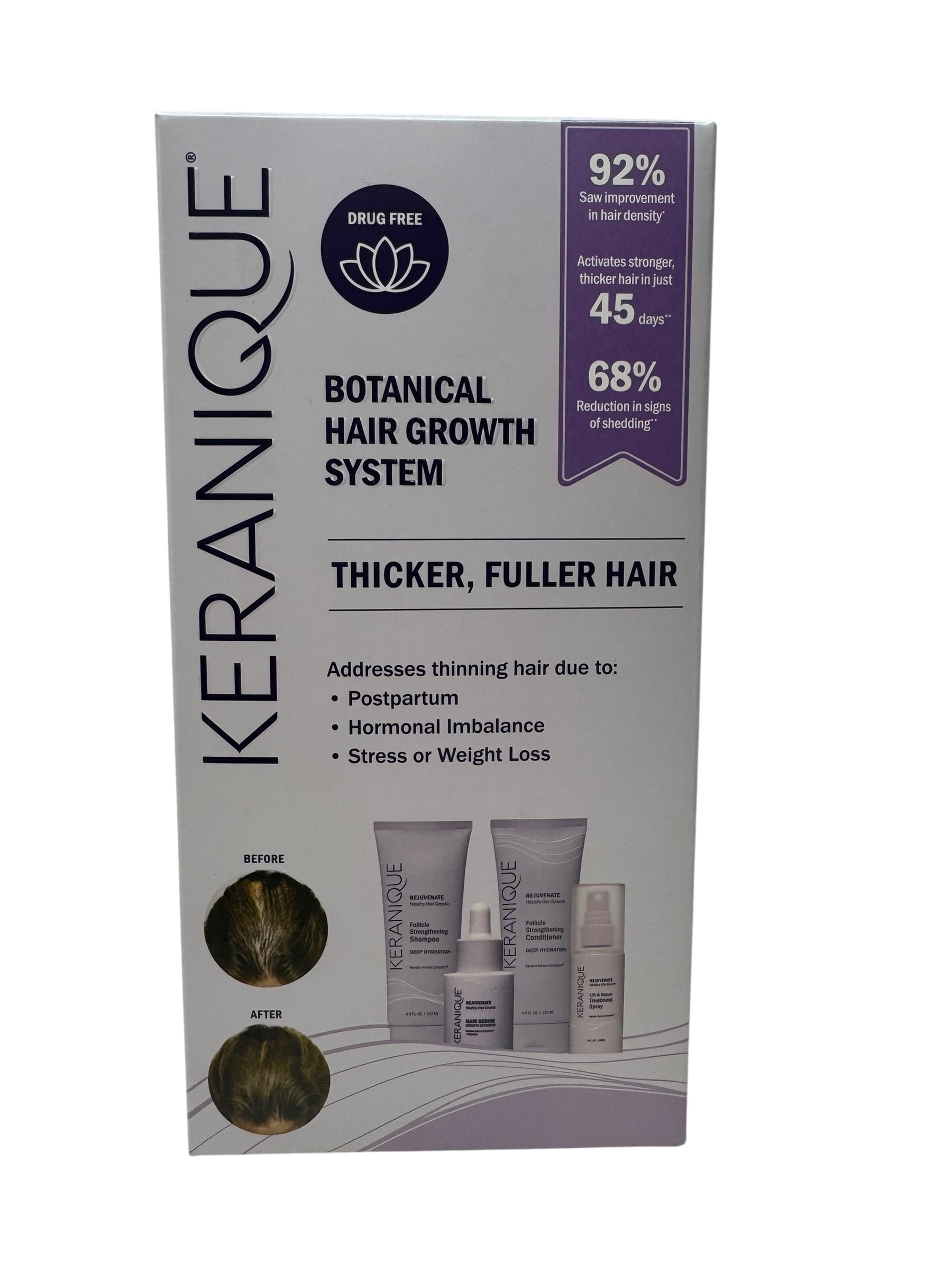 Revive Procare Hair Loss Reduction Kit - 3 Part System with Revive Procare Hair Loss Reduction Kit - 3 Part System with