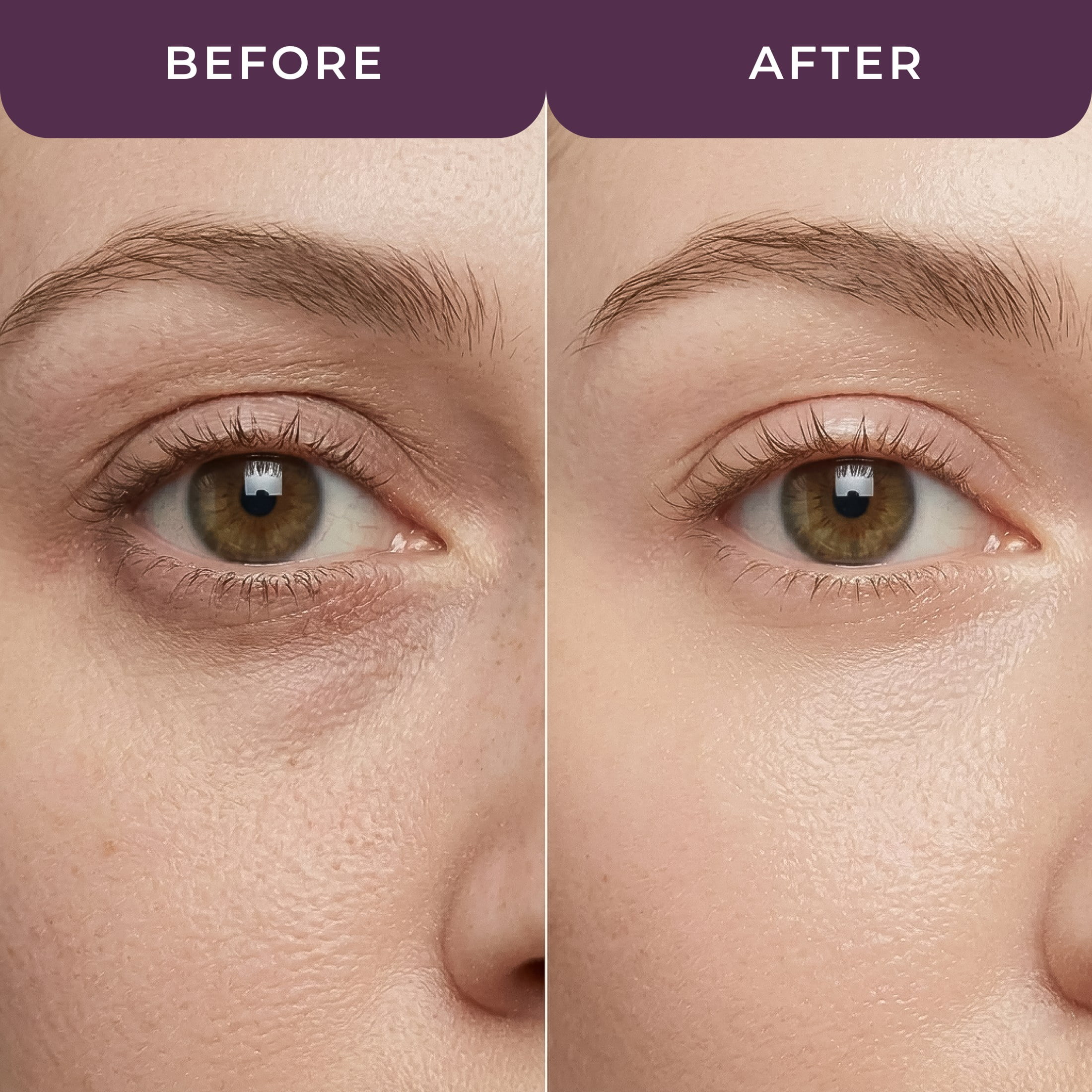 Tarte Maracuja C-Brighter Eye Treatment, Vitamin C Under Eye Cream for Dark Circles, Hydrating and Anti-Aging Eye Cream, 0.35 oz