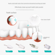 thumbnail image 1 of Pulidor de dientes Cepillo de dientes eléctrico Medidor de belleza para dientes Limpiador dental eléctrico Cepillo de dientes para adultos Limpieza de dientes Manchas de humo Placa dental, 1 of 4