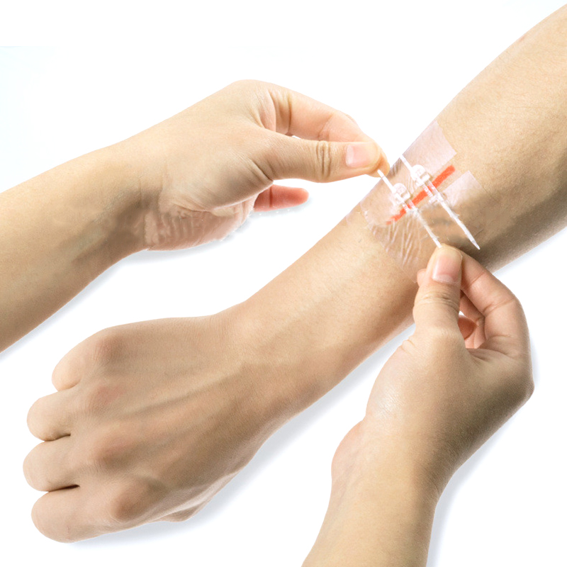 Zipper Bandaid Painless Wound Closure Device Patch Zip Suture Reducer