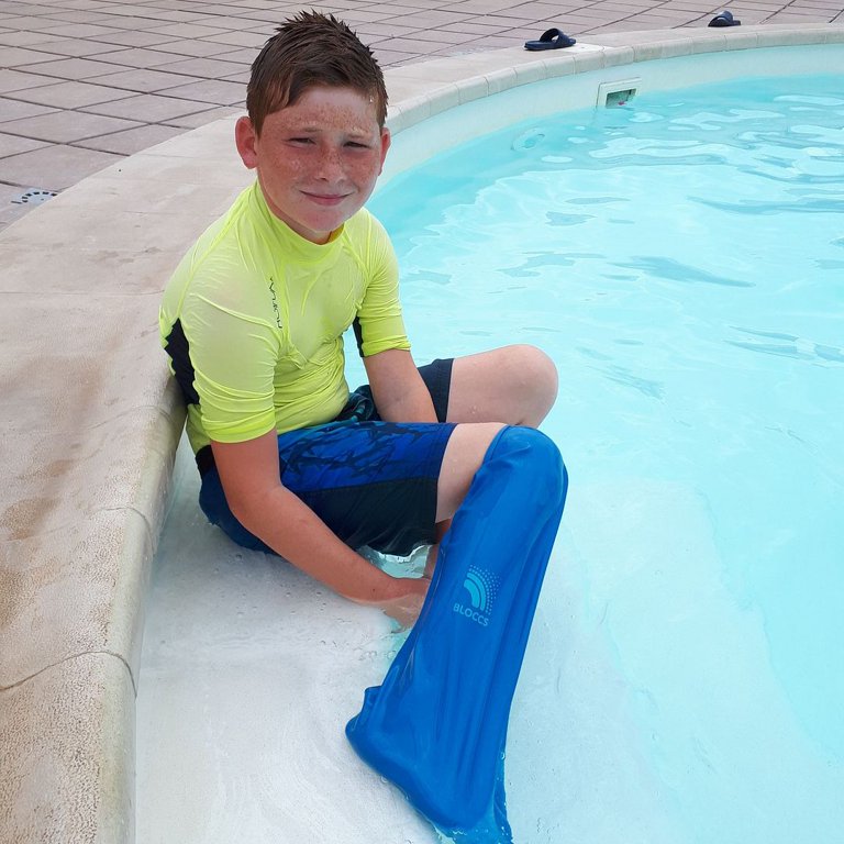 Regular Casts Vs Waterproof Casts Which One Is Best For, 60 OFF