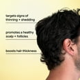 thumbnail image 2 of Bondiboost Intensive Thickening Spray [4.23 Fl Oz] Daily Leave In Hair Treatment To Reduce Hair Loss Lightweight Mist For Thinning Hair + Density For Men & Women Rosemary & Tea Tree Formula, 2 of 4