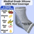 thumbnail image 3 of 6 Pairs, Moisturizing Socks for Cracked Heel Treatment: Heel Repair, Silicone Toeless, Spa Gel for Dry feet Women, Lotion Moisture Pedicure, Multicolor, 3 of 6