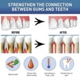 thumbnail image 4 of Gum Therapy Gel, Gum Therapy Gel Pen, Safe And Effective Teeth Whitening Gel, Nature Teeth Whitening Essence Pen, 4 of 5