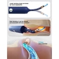 thumbnail image 3 of Herramienta para eliminar la cera de los oídos Cámara BEBIRD Earsight Plus WiFi Blue, 3 of 7