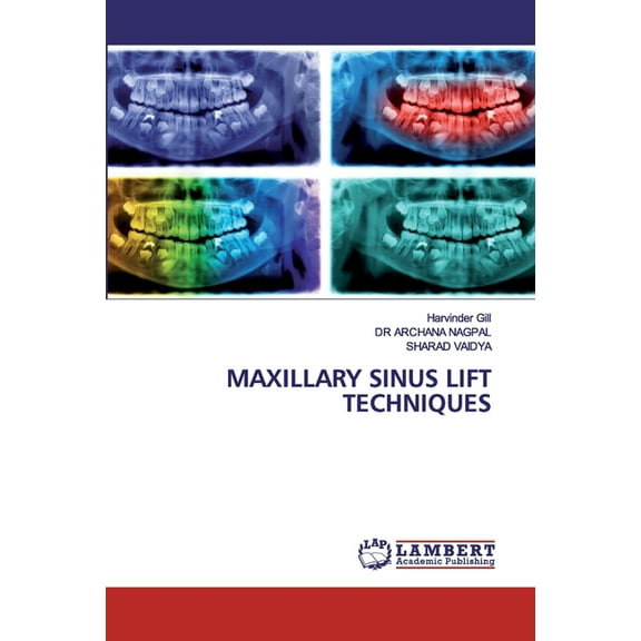 Maxillary Sinus Lift Techniques (Paperback)